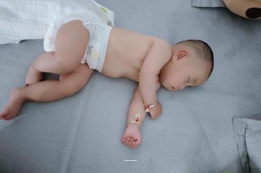 阿克苏六个月宝宝眼睛散光